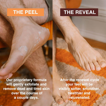 FEETS ingredientes naturales exfoliacion piel de los pies