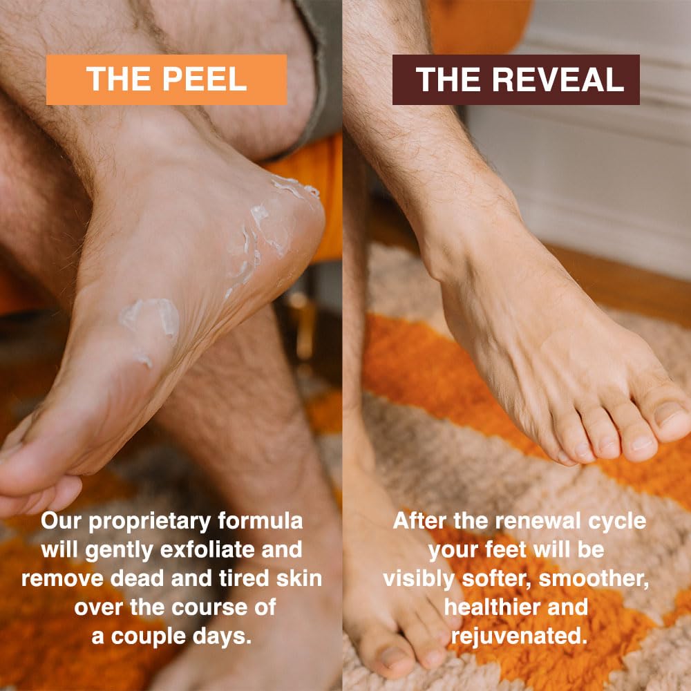 FEETS ingredientes naturales exfoliacion piel de los pies