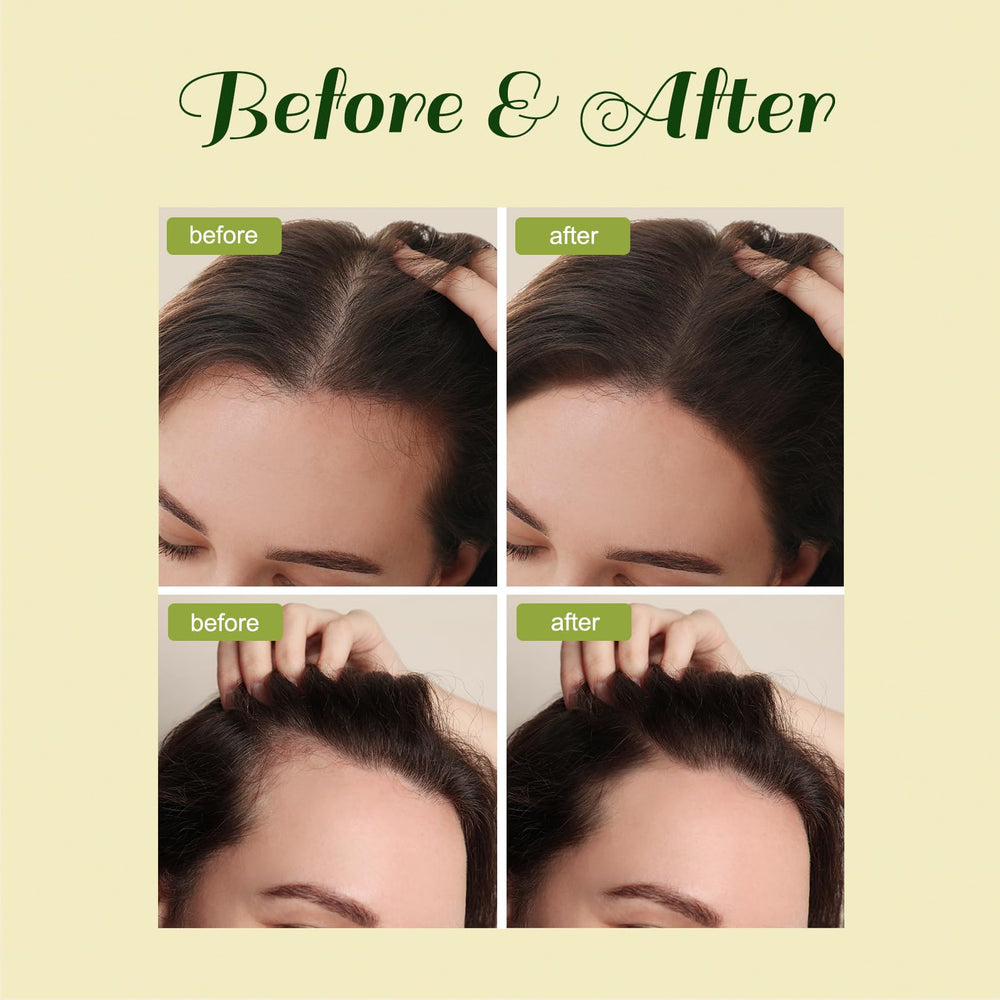 FEIBTH Aceite Batana Romero, favorece la nutrición y brillo del cabello.
