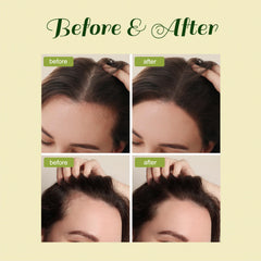FEIBTH Aceite Batana Romero, favorece la nutrición y brillo del cabello.