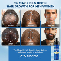 Aplicación rápida y precisa de Felicemy Minoxidil 5% spray.