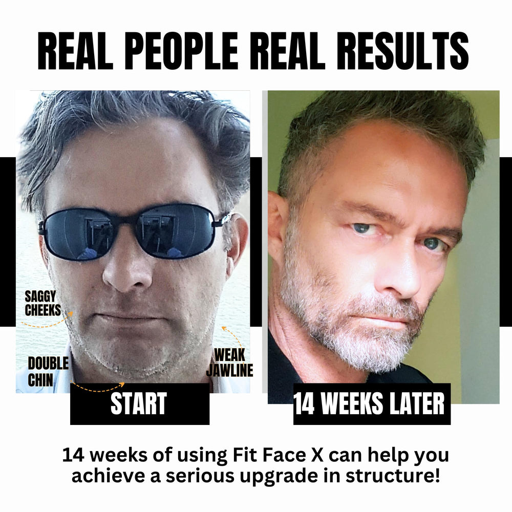 FFX Face X: gimnasio facial completo para 4 minutos diarios en casa.