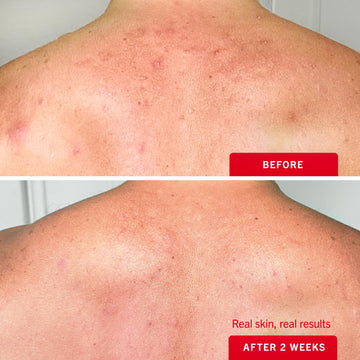 First Aid Beauty: aplicación fácil en áreas difíciles de alcanzar