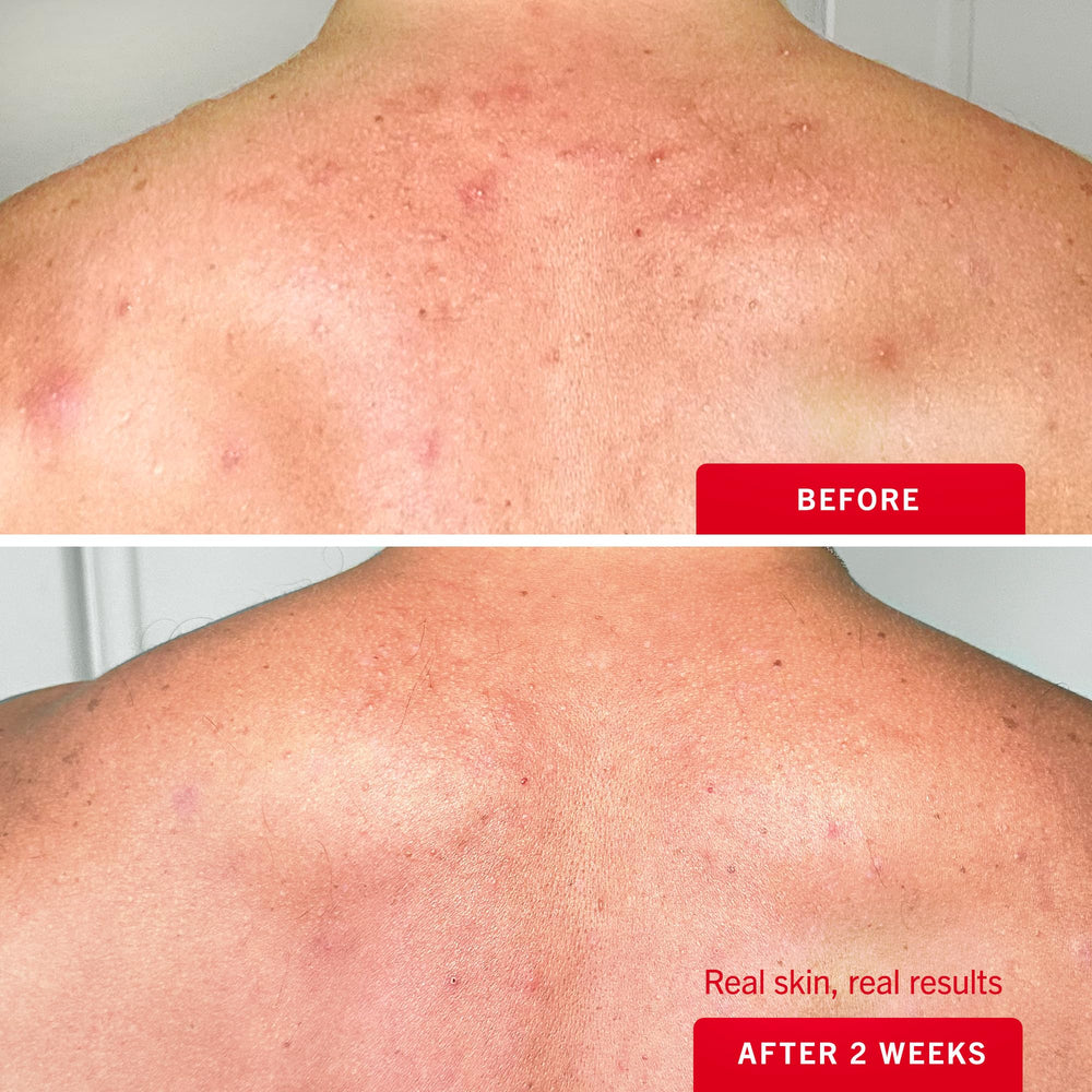 First Aid Beauty: aplicación fácil en áreas difíciles de alcanzar