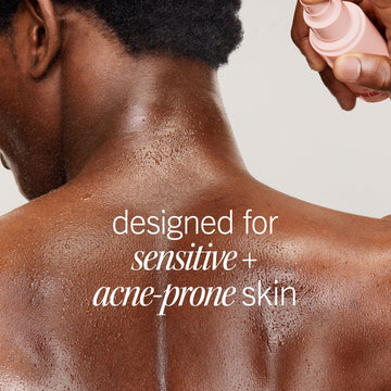 First Aid Beauty: textura de niebla fina para uso suave