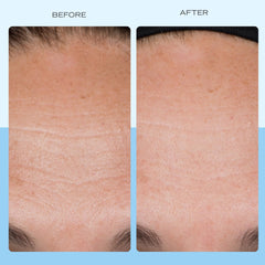 First Aid Beauty crema-firmeza-colageno-aplicacion-diaria en rostro, sensación fresca.