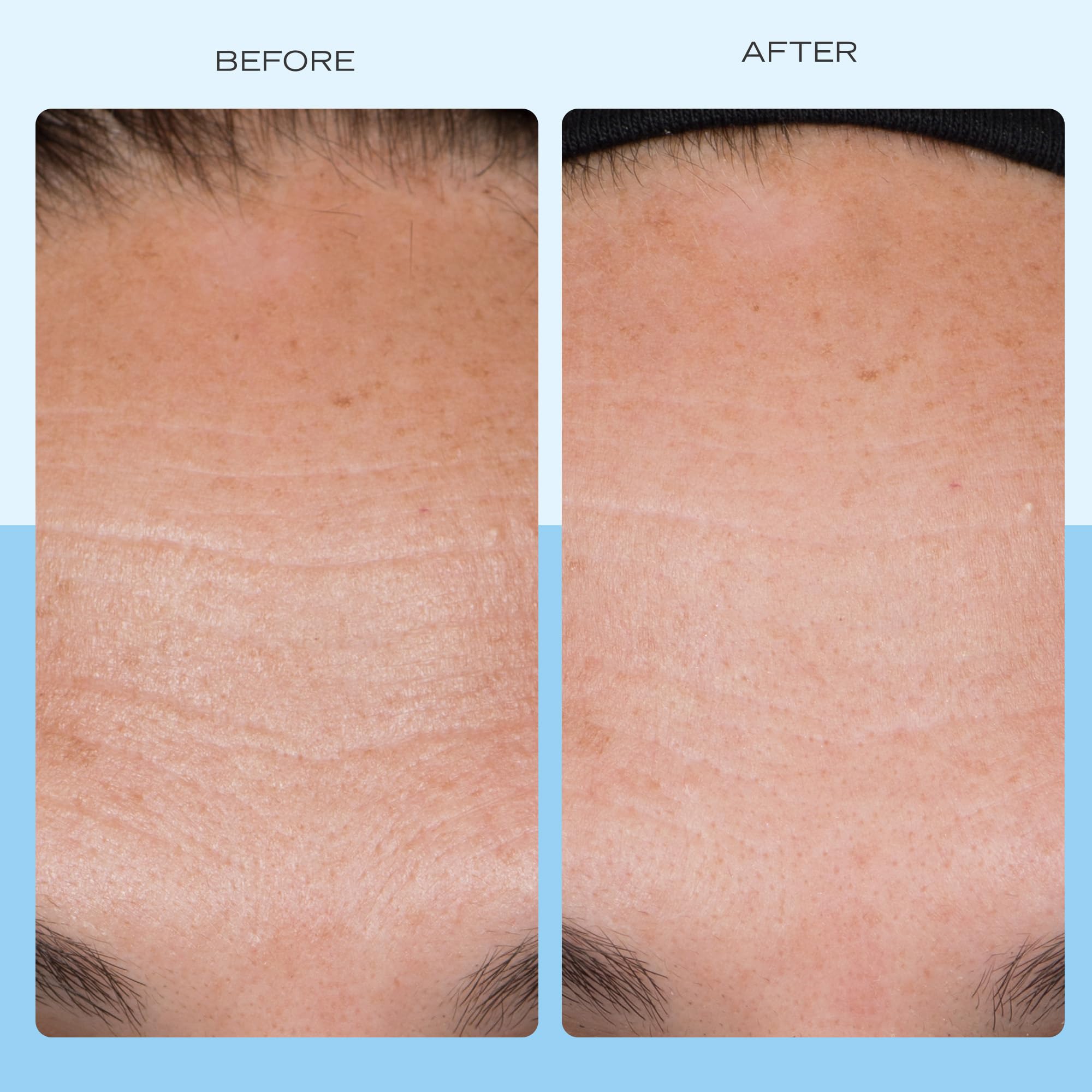 First Aid Beauty con colágeno, péptidos y niacinamida para soporte de la piel