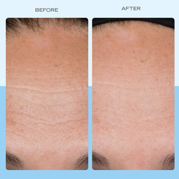 First Aid Beauty con colágeno, péptidos y niacinamida para soporte de la piel