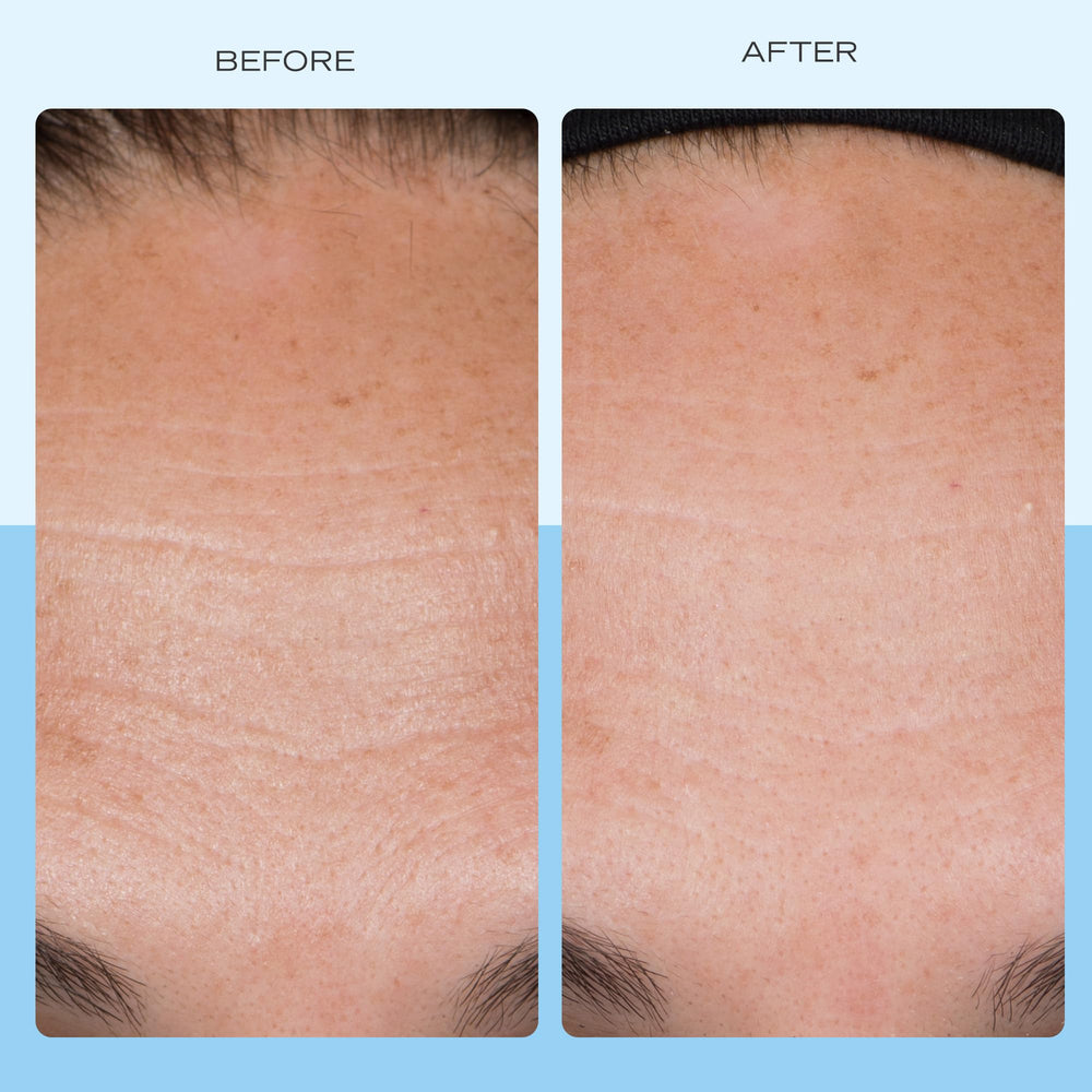 First Aid Beauty con colágeno, péptidos y niacinamida para soporte de la piel