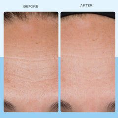 First Aid Beauty con colágeno, péptidos y niacinamida para soporte de la piel