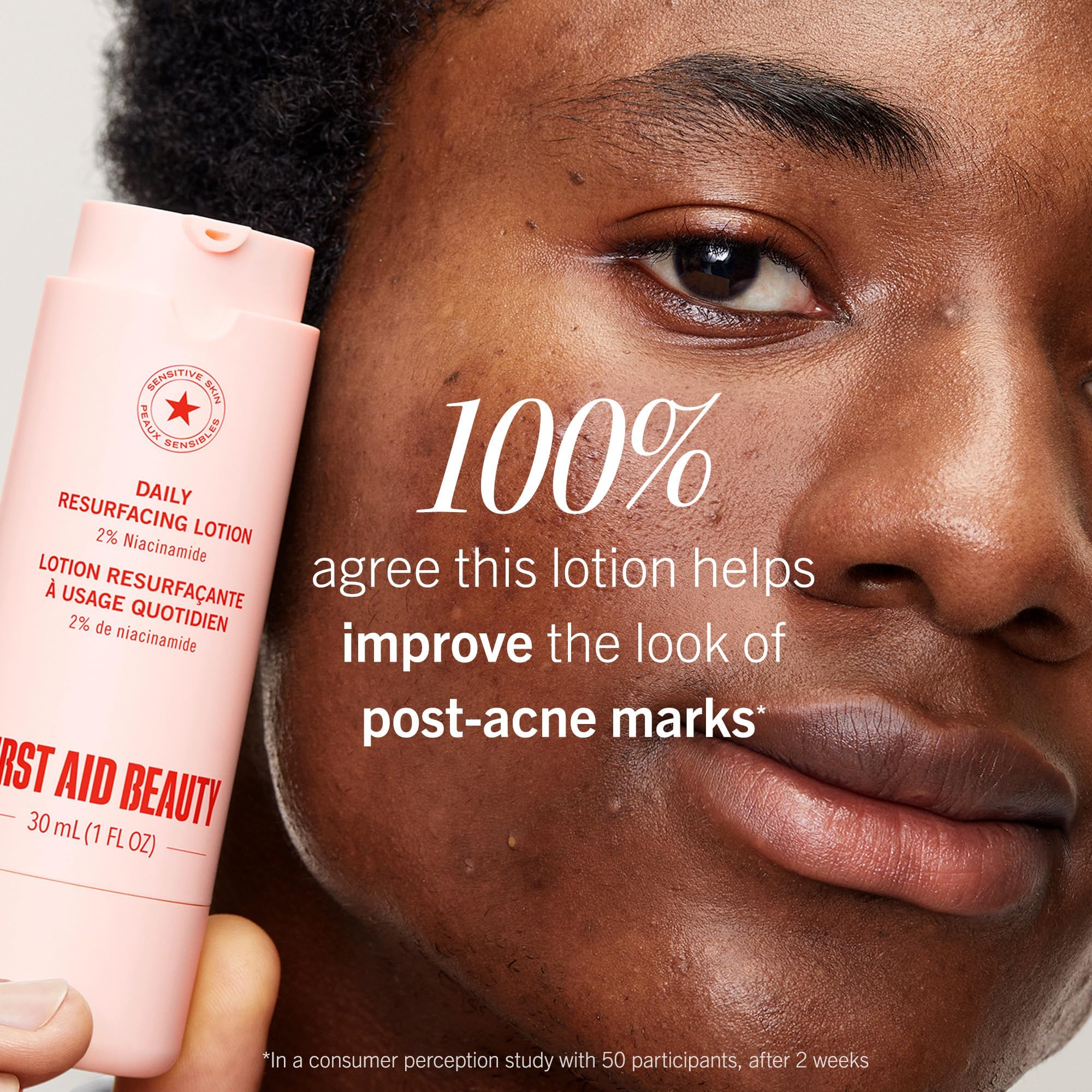 First Aid Beauty Envase compacto de 1 oz para cuidado diario.