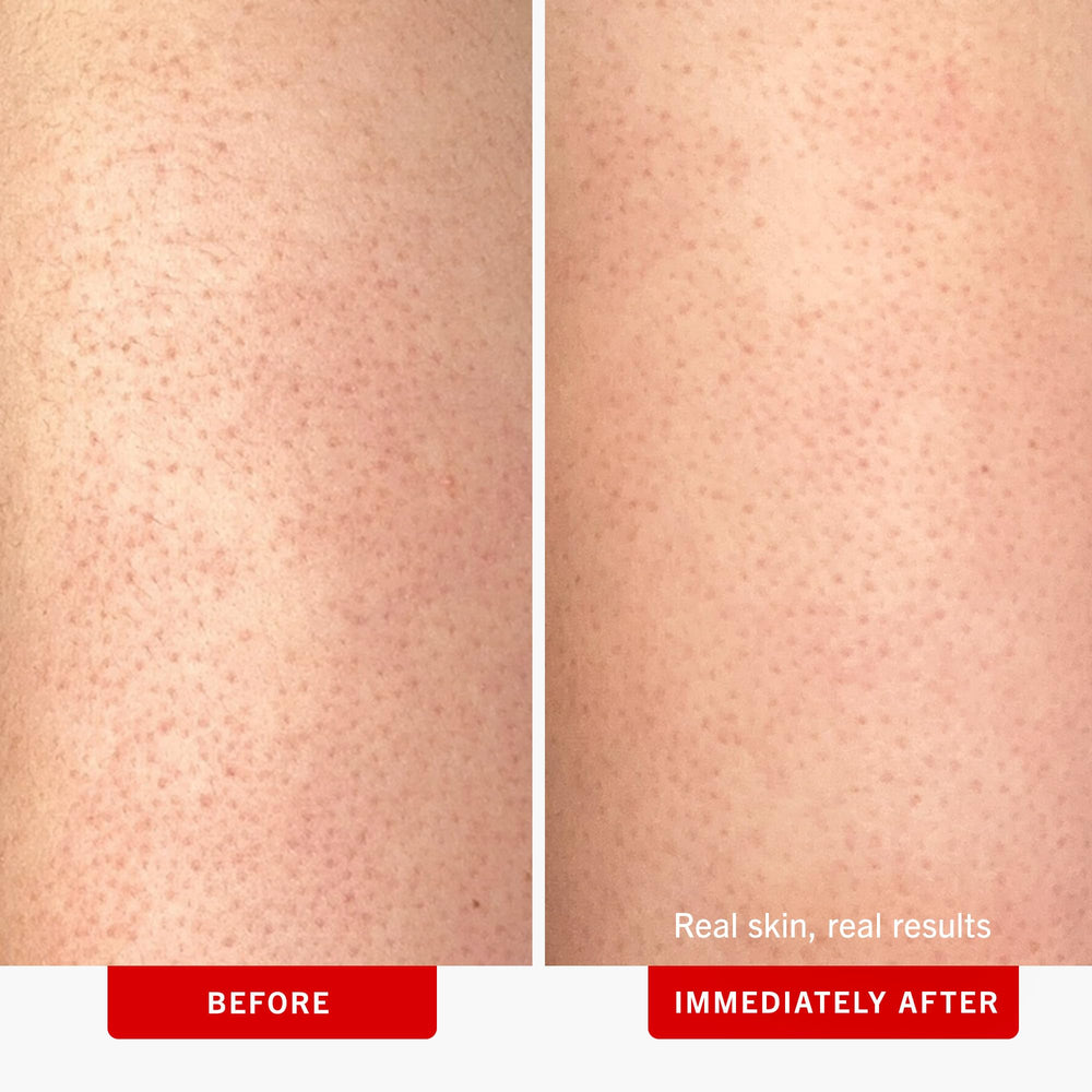 Exfoliation chimique 10% AHA du First Aid Beauty: pores clarifiés et peau plus lumineuse.