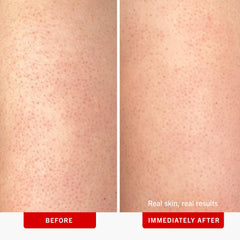 Exfoliation chimique 10% AHA du First Aid Beauty: pores clarifiés et peau plus lumineuse.