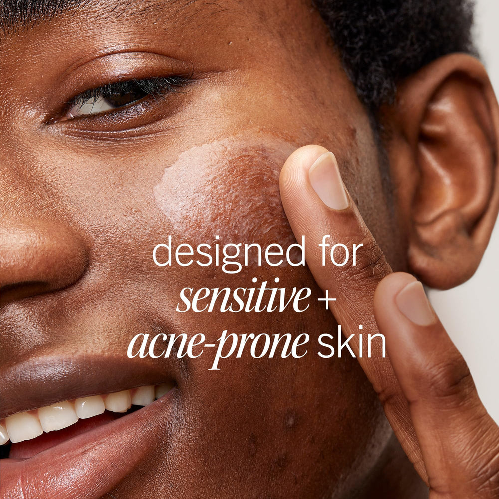 First Aid Beauty Mejora visible de marcas pos-acné y manchas oscuras.