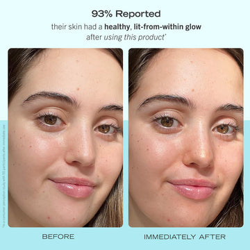 First Aid Beauty piel sensible apto y sin irritantes