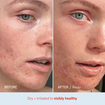 Absorción rápida de Ultra Repair Cream sin sensación grasa de First Aid Beauty