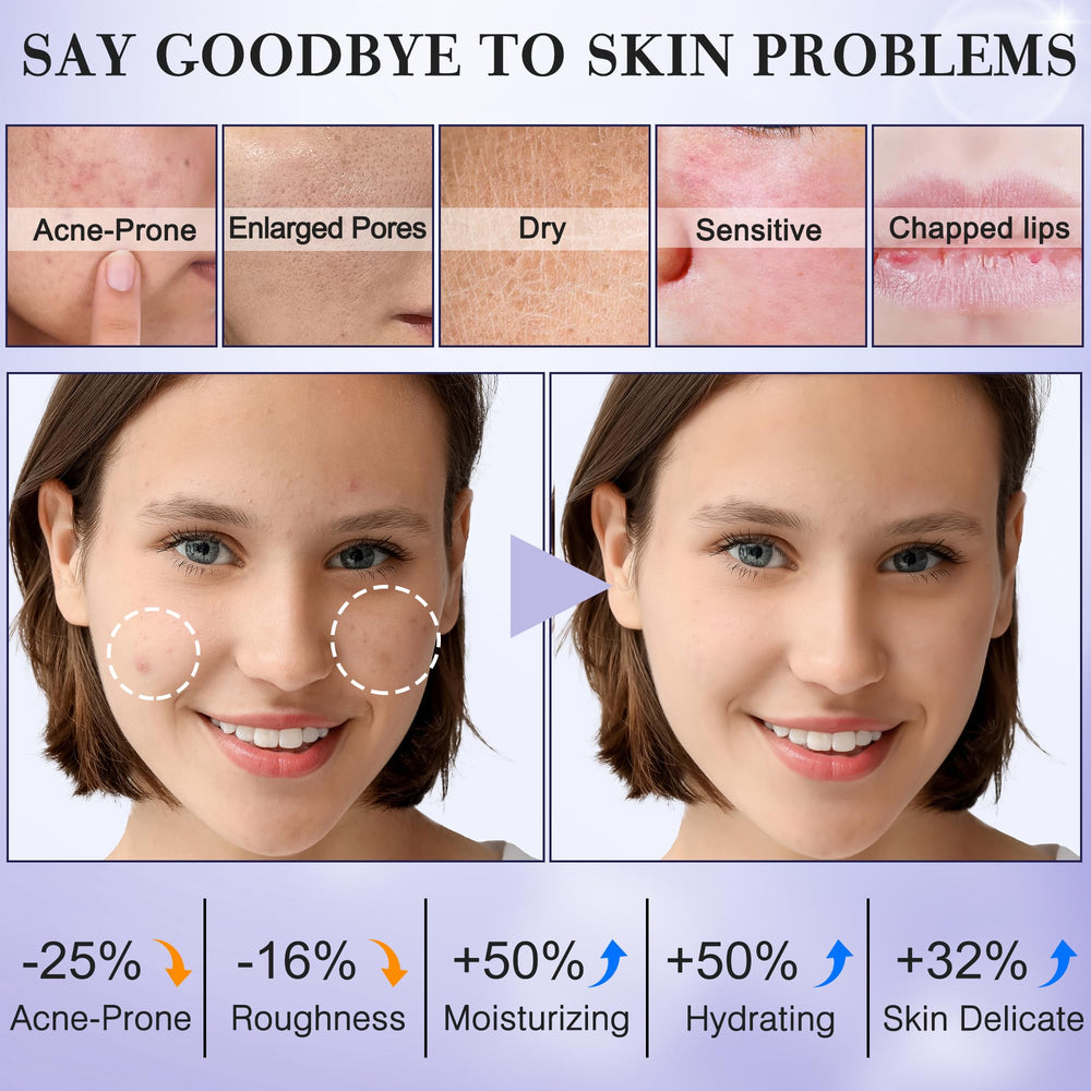 FITOEG tónico facial para adolescentes: hidratación ligera y purificación de poros.