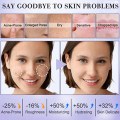 FITOEG tónico facial para adolescentes: hidratación ligera y purificación de poros.