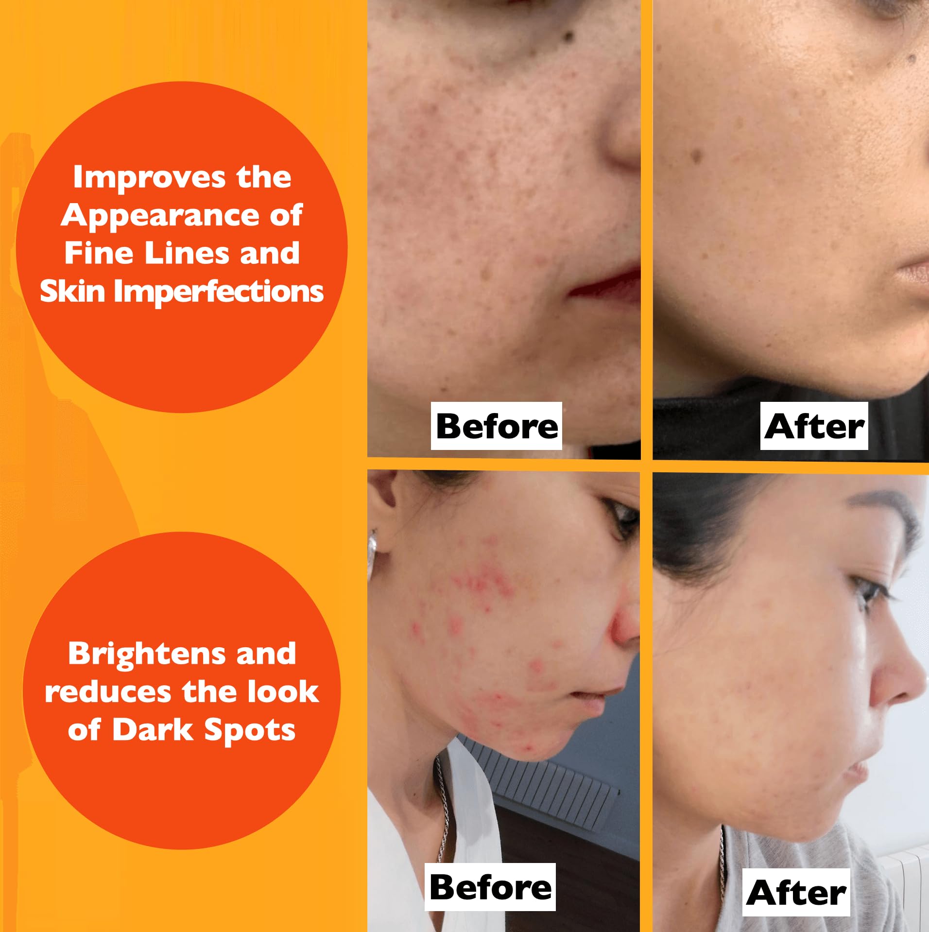 Florence Serum Vitamina C, rutina diaria para piel hidratada y radiante.