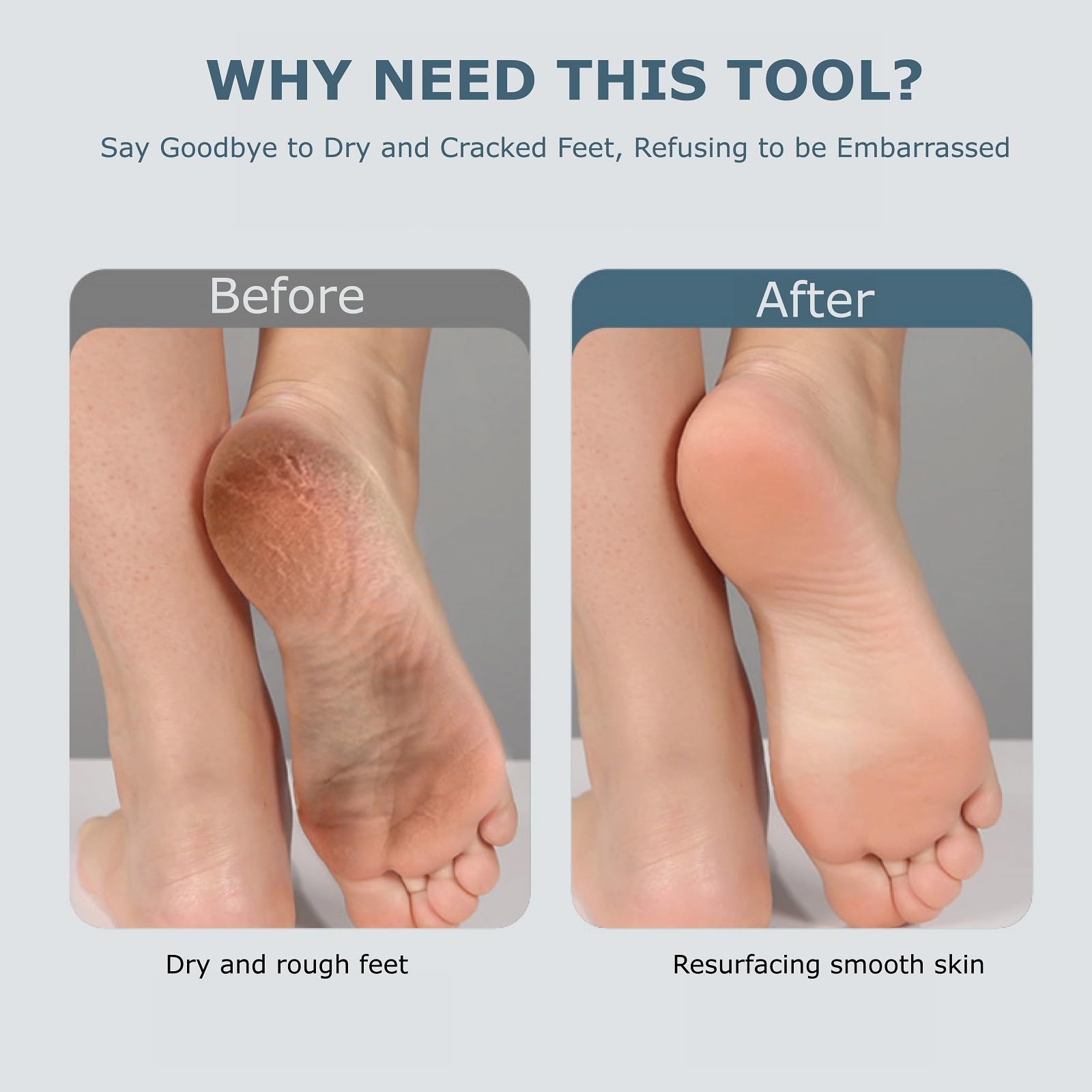 Fooseey exfoliador de pies, diseño-ergonomico para agarre cómodo.