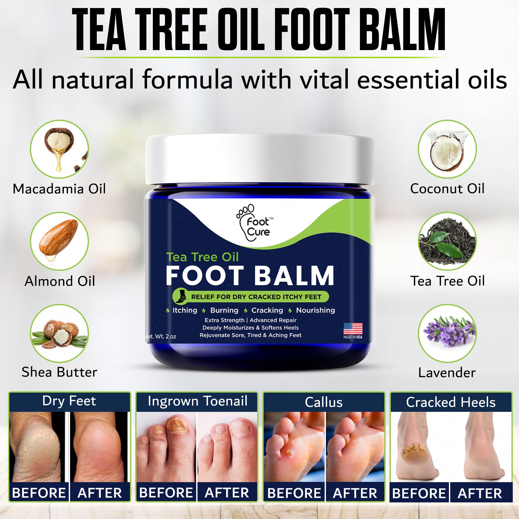 Foot Cure hidratacion profunda para pies secos con baja grasa