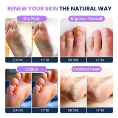 Foot Cure detox-pies aceite-arbol-te para renovacif3n