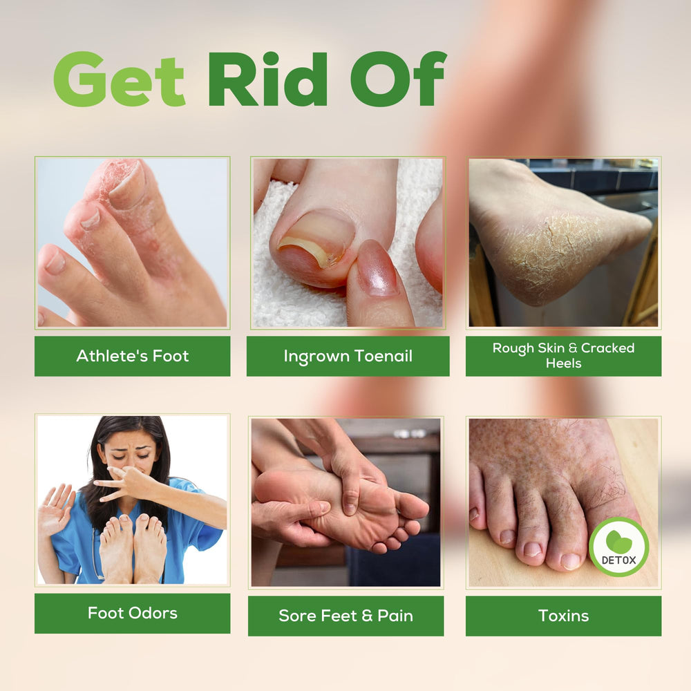 FOOT CURE : parfum frais atténuant les odeurs des pieds.