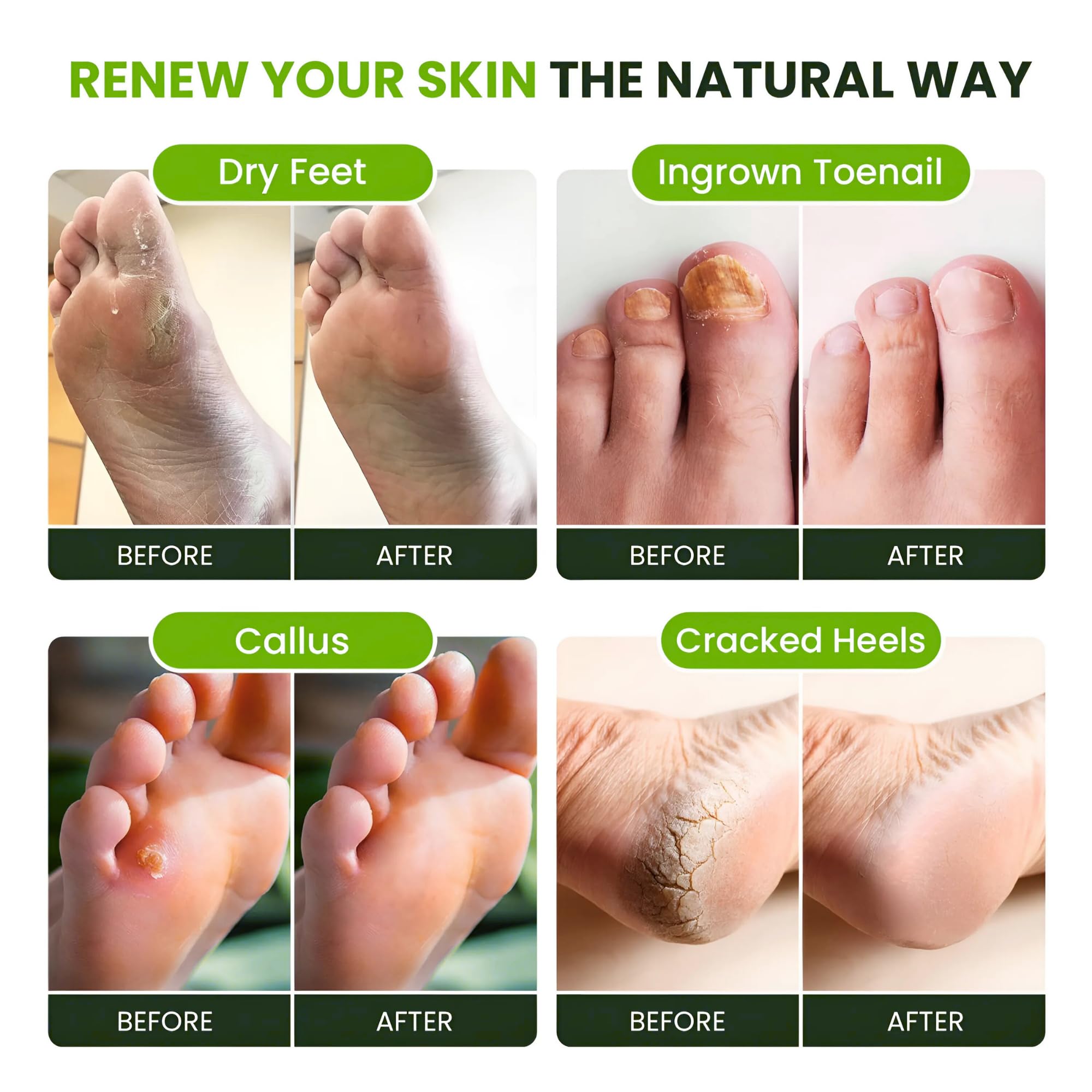 FOOT CURE : pieds sensibles, formule douce respectant la peau.
