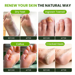 FOOT CURE : pieds sensibles, formule douce respectant la peau.