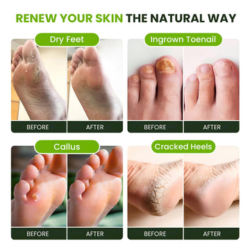 Foot Cure: piel de pies suave tras el baño