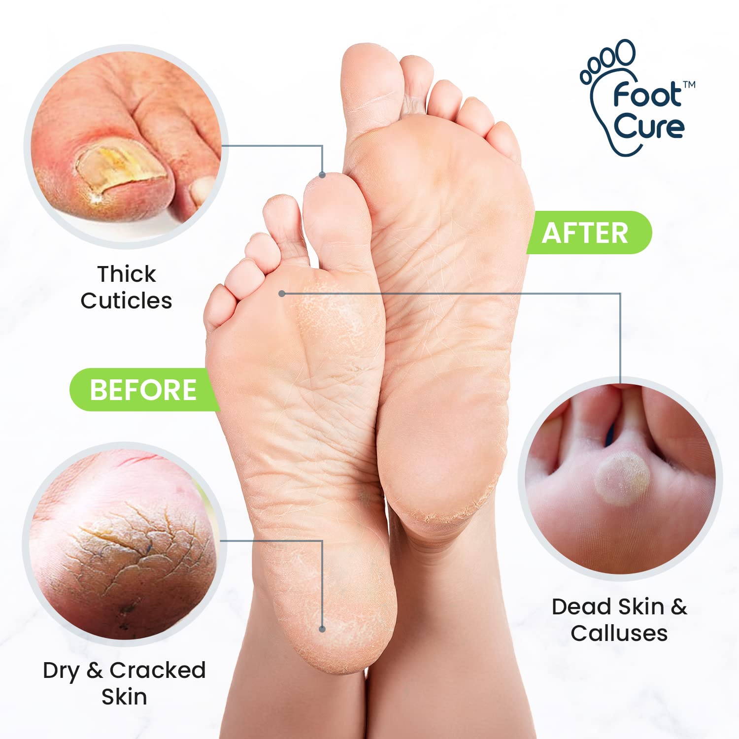 Foot Cure: sal de epsom para pie con relax y suavidad