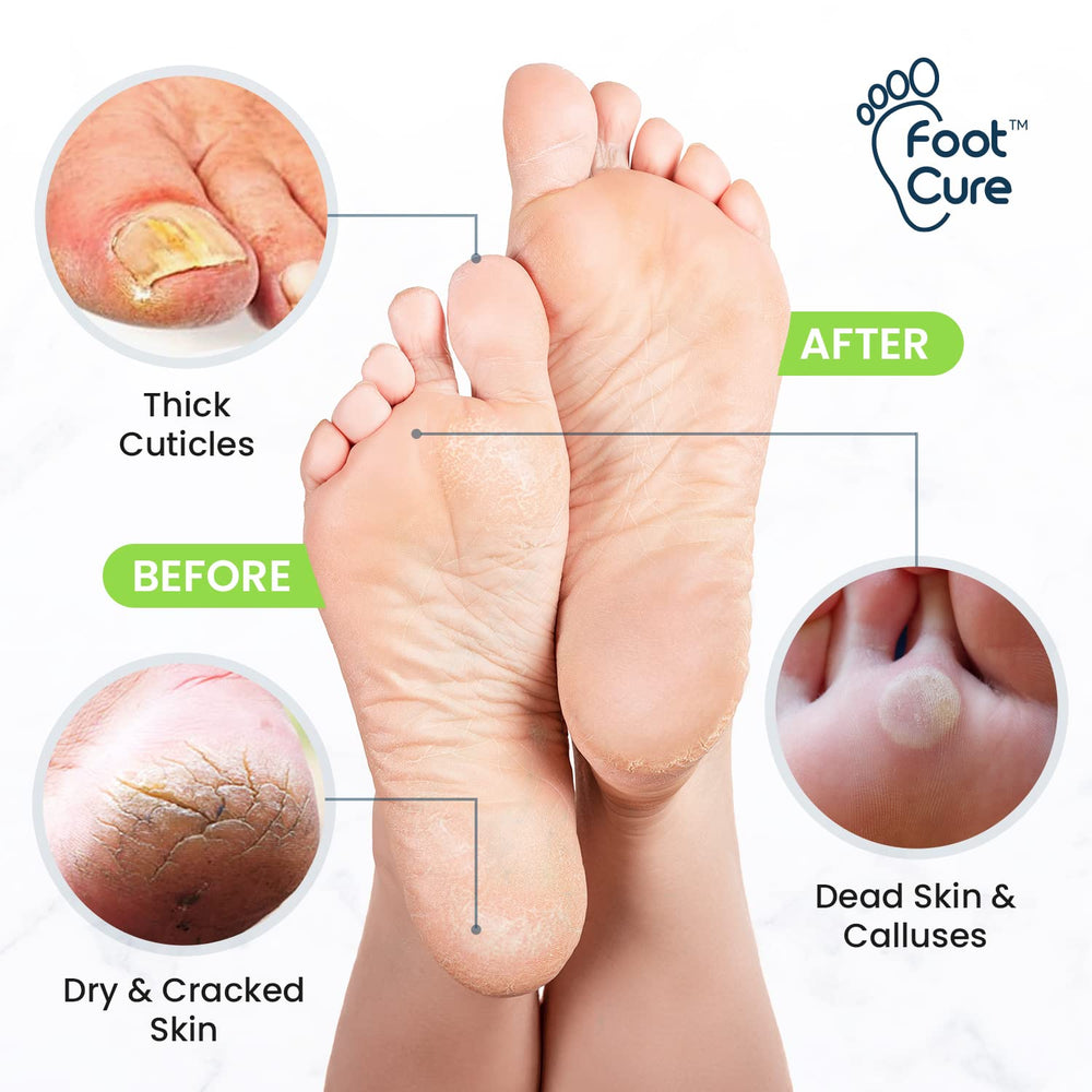 Foot Cure: sal de epsom para pie con relax y suavidad