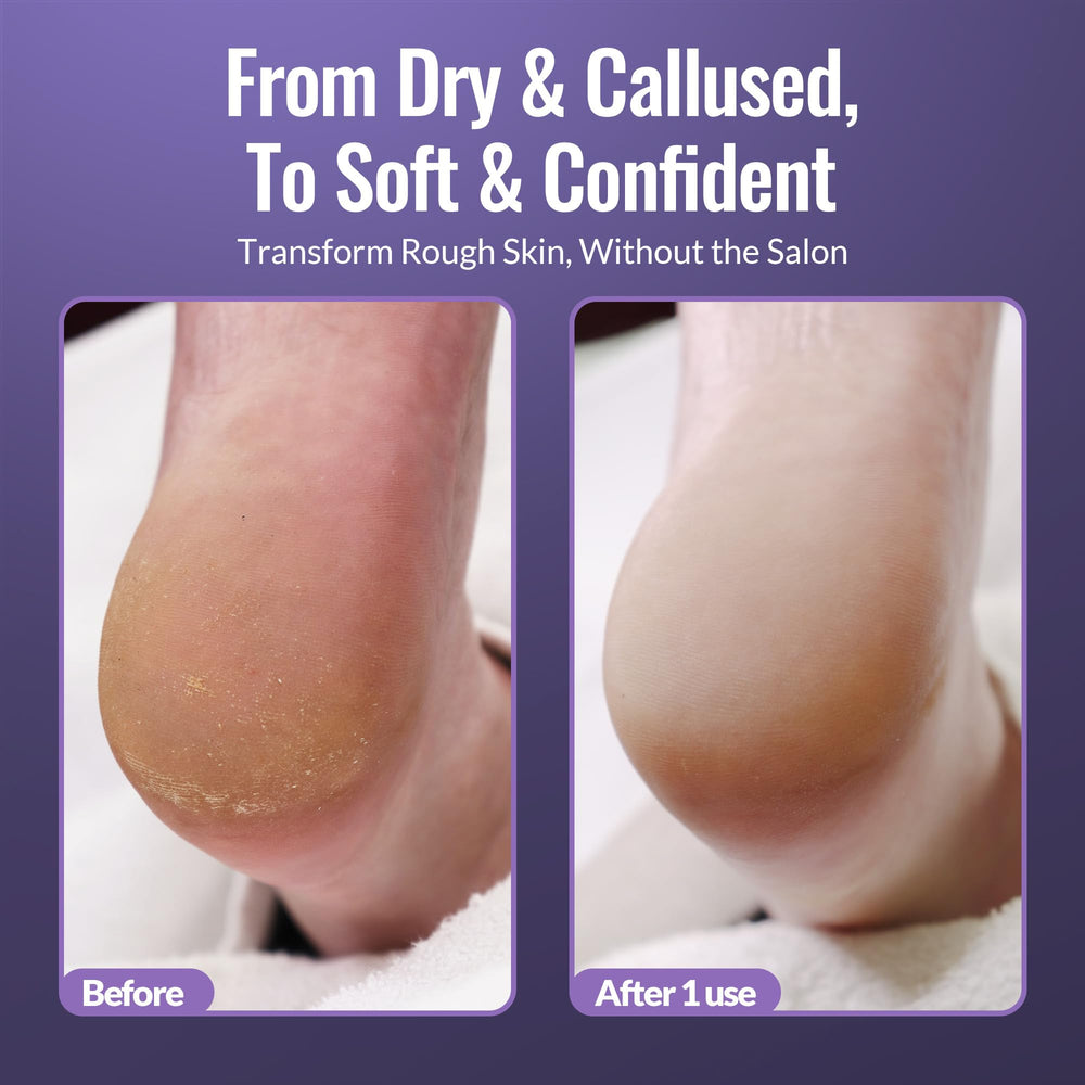 Footlogix aplicación con pasos, guía para pedicure en casa