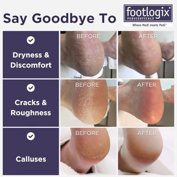 Footlogix mango gomoso, agarre cómodo para un pulido seguro
