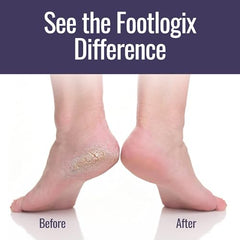 Footlogix talones secos muestra el estado previo al tratamiento