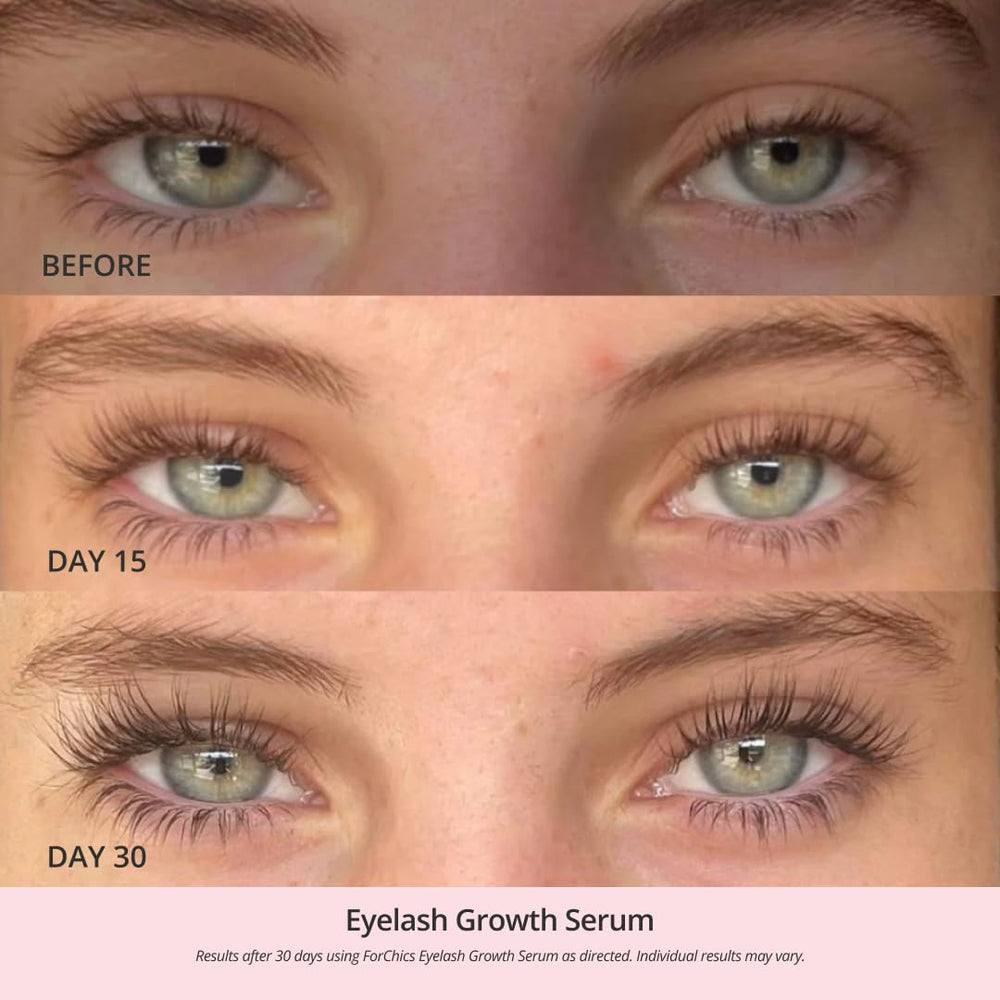 ForChics Serum, envase de 3 ml para uso diario