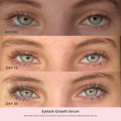 ForChics Serum, envase de 3 ml para uso diario