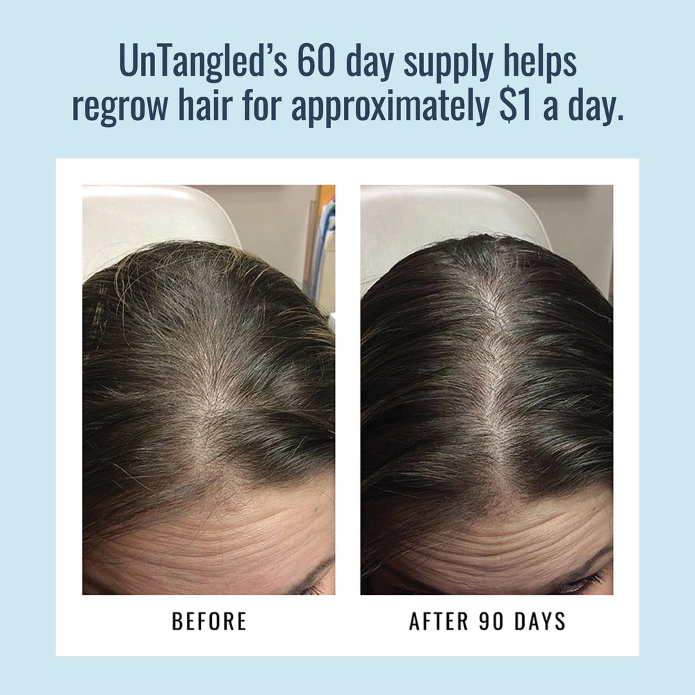 Foundation Skincare Untangled: envase promociona resultados potenciales en crecimiento capilar.