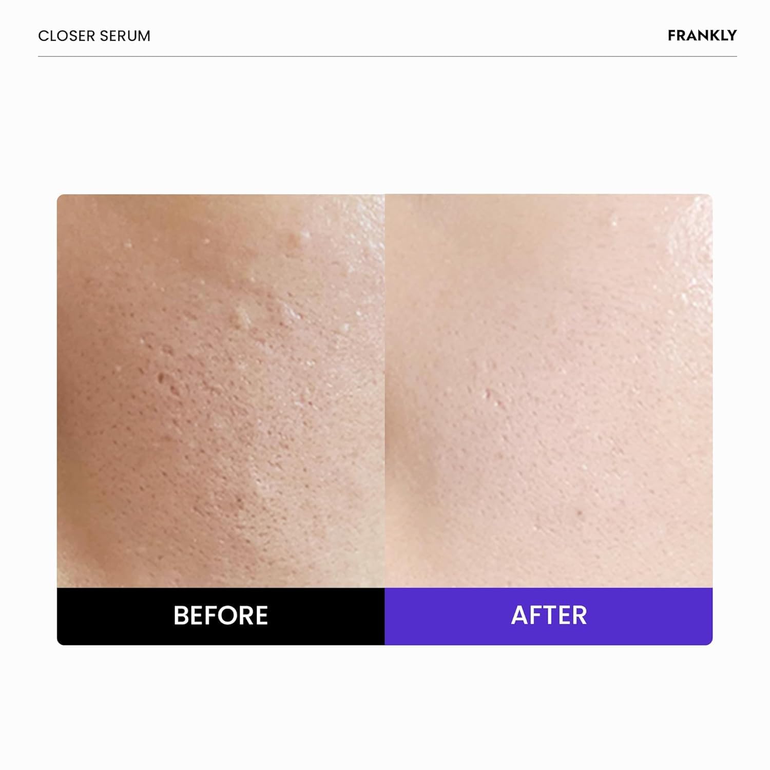 FRANKLY Closer Serum textura gel suave al aplicar