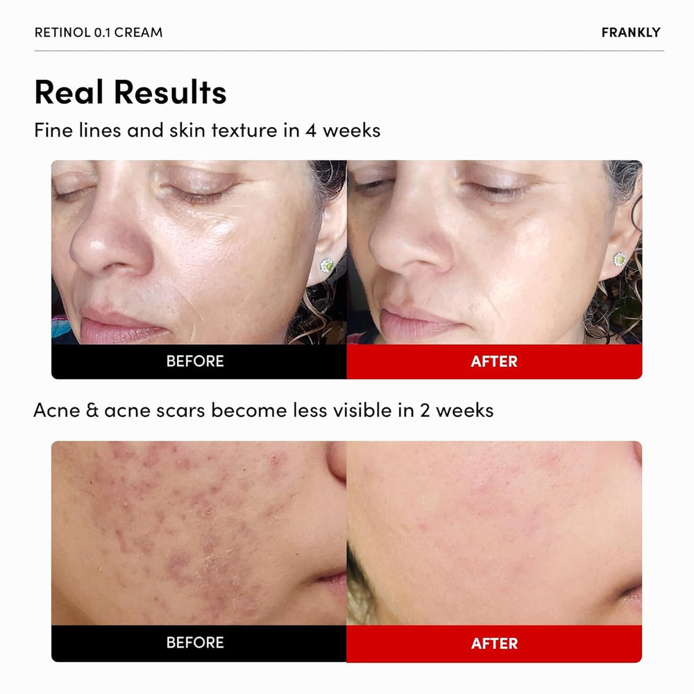 Textura cremosa de FRANKLY Retinol 0,3% crema para aplicación nocturna suave