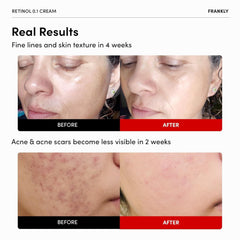 Textura cremosa de FRANKLY Retinol 0,3% crema para aplicación nocturna suave