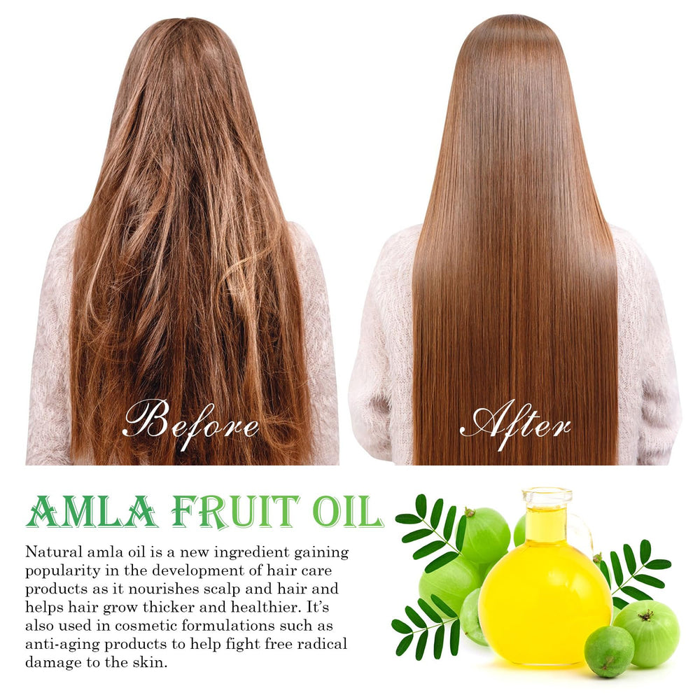 Aplicación de FSLHCY Amla Oil en las manos para cuero cabelludo nutrido.