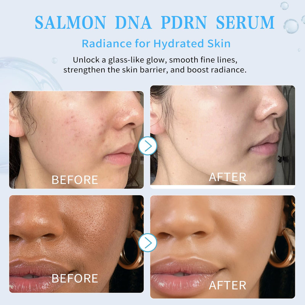 Fstudant serum hialuronónico 6D: hidratación y volumen instantáneos.