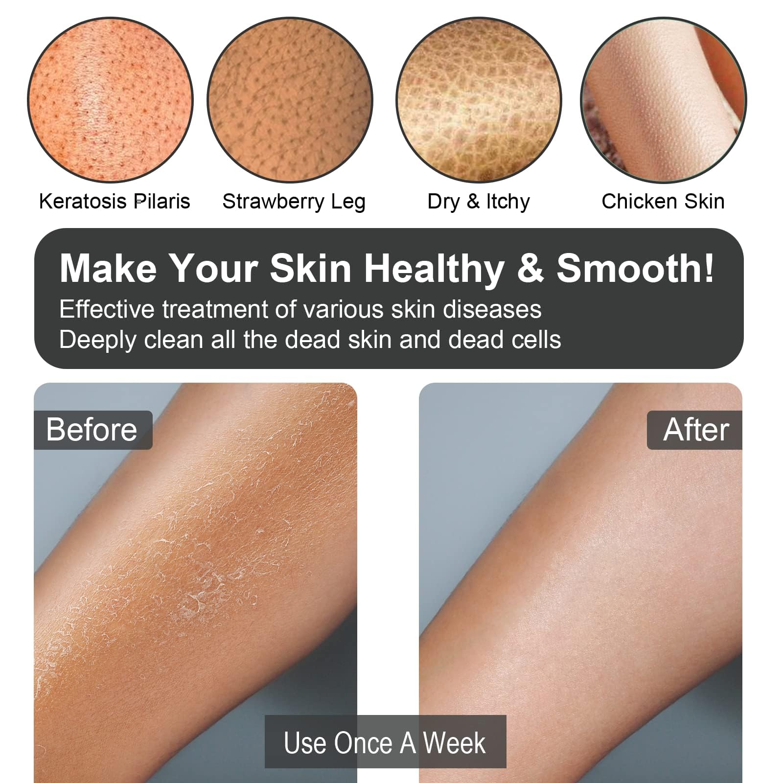 Mitón exfoliante corporal Fundrem negro, ideal para scrub suave y eficaz