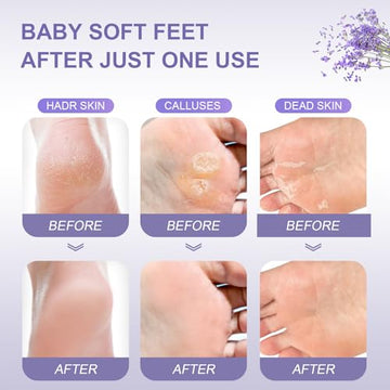FUNNIR Foot Peeling Mask natural extracts nourish and hydrate skin.
