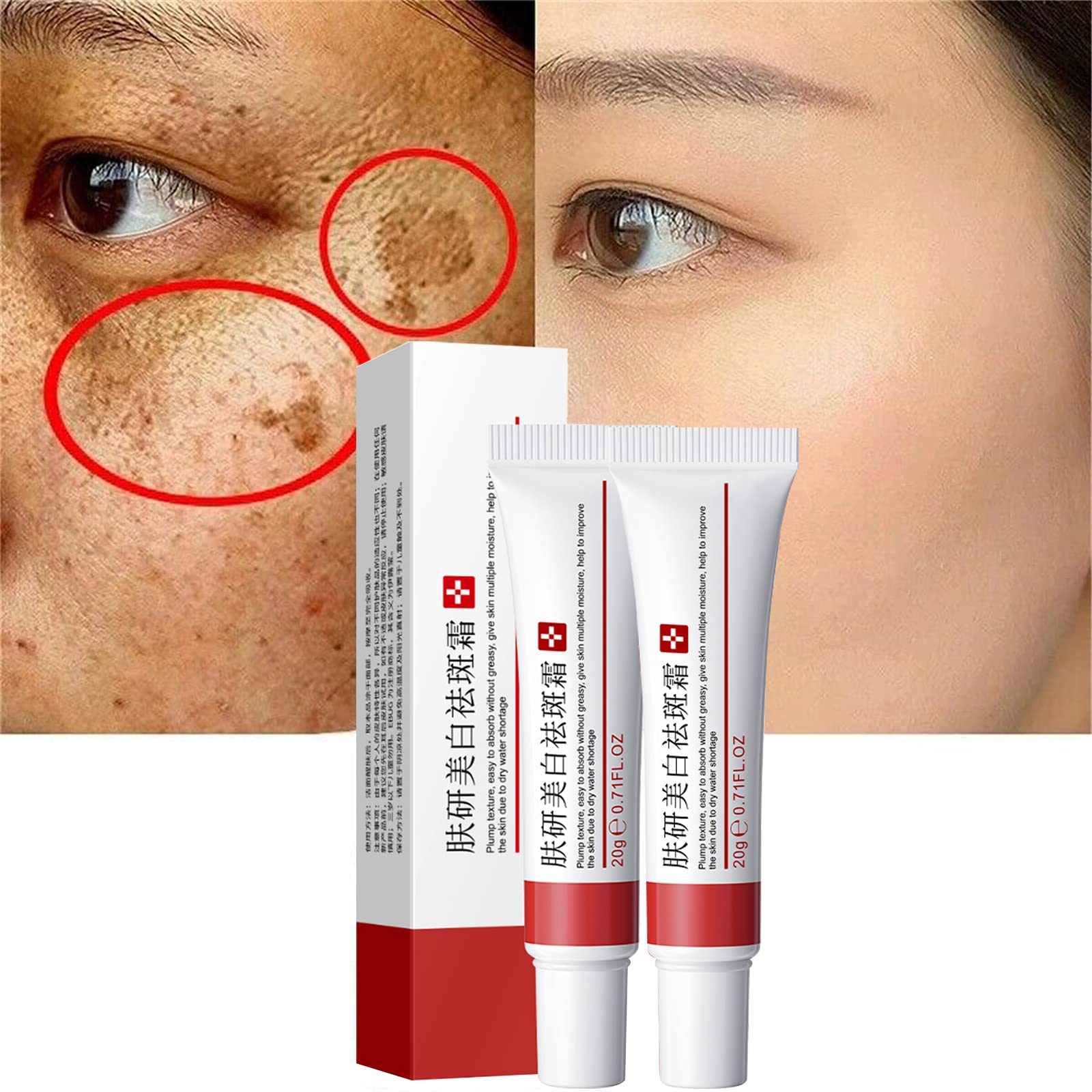 Fupah crema blanqueadora para manchas faciales, tono más uniforme.