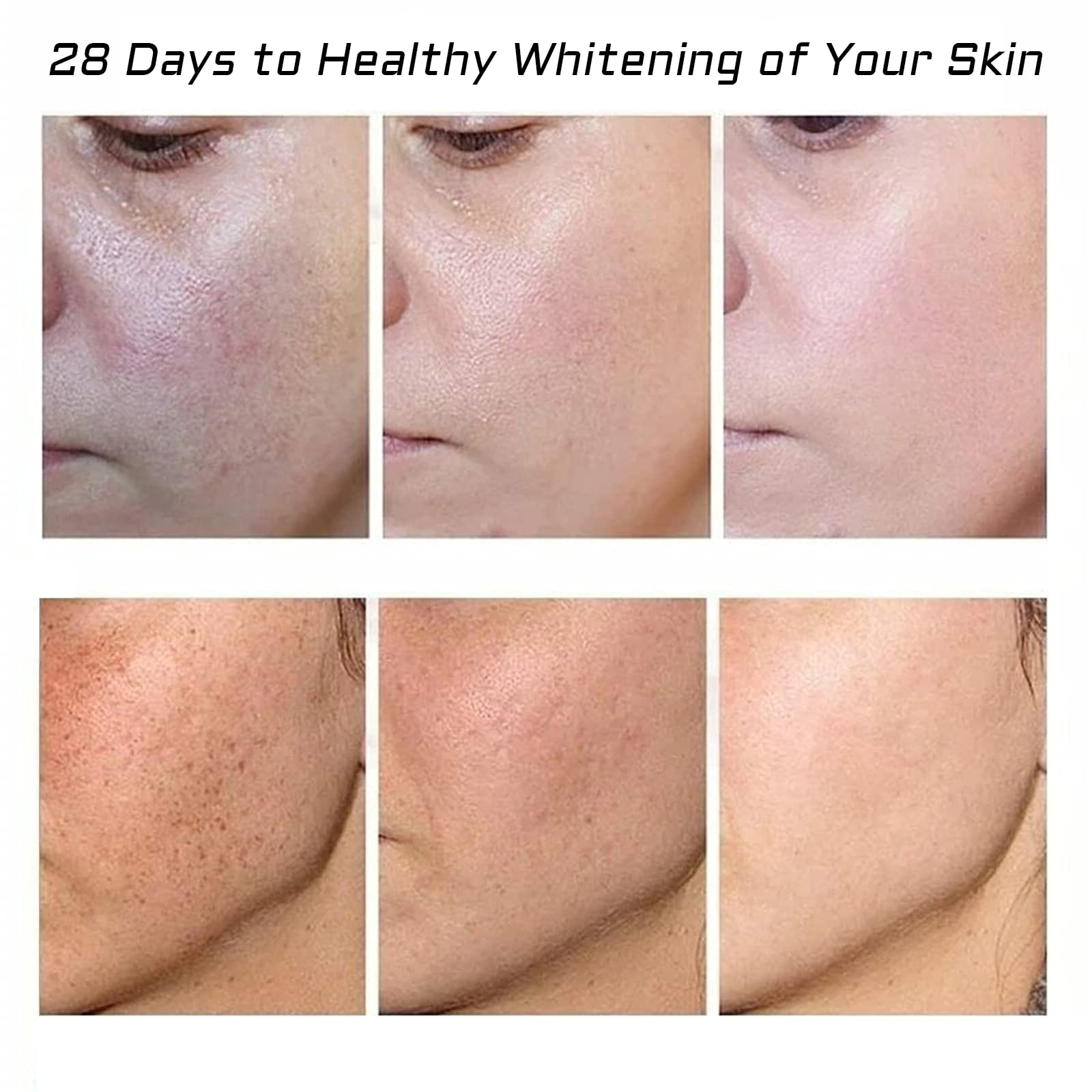 Fupah crema pigmentación y melasma, mejora la apariencia de manchas.