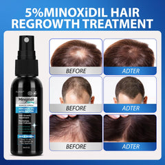 Applied to dry scalp, FUZYAT supports the look of fuller hair