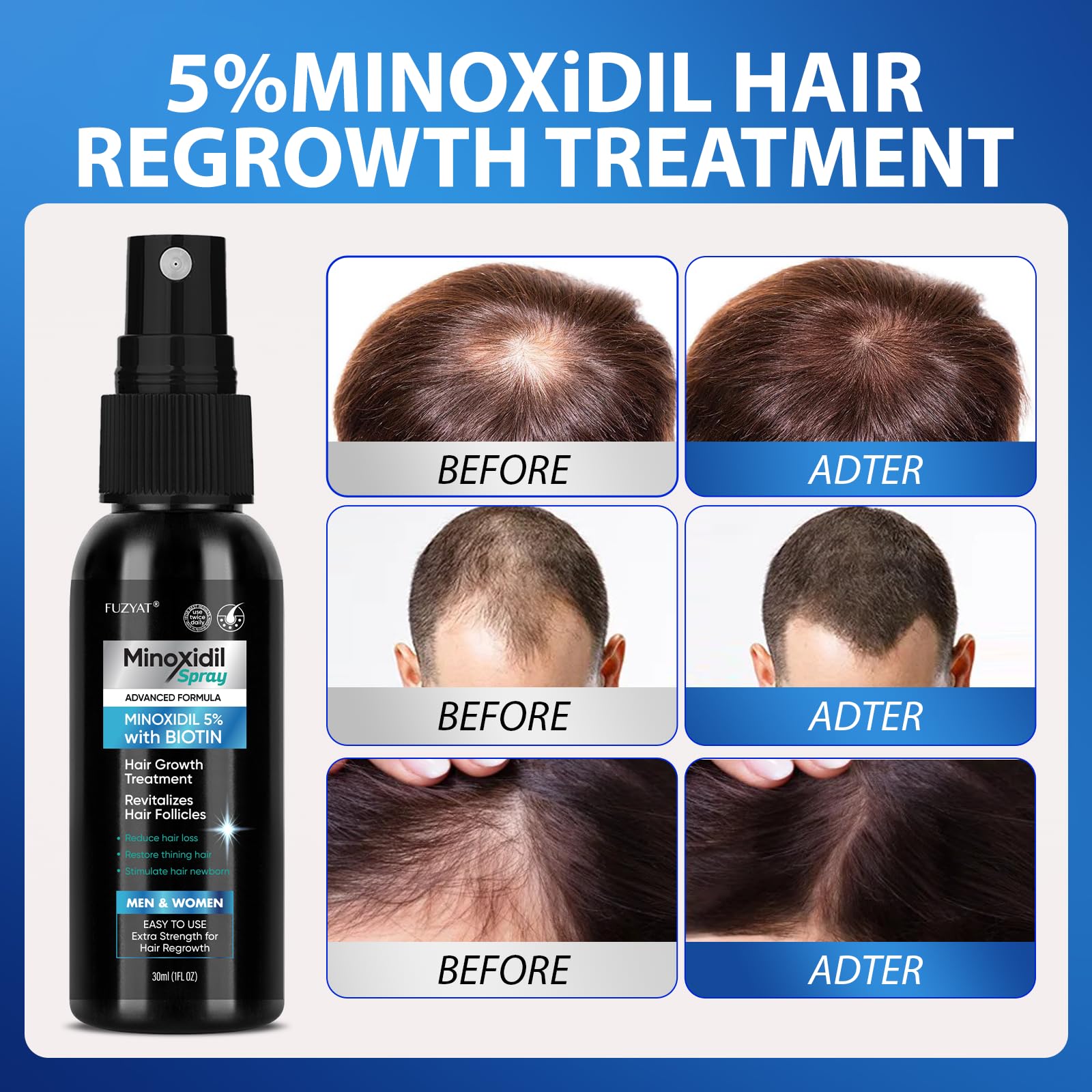 Aplicación de 1 ml en cabello seco para resultados consistentes.