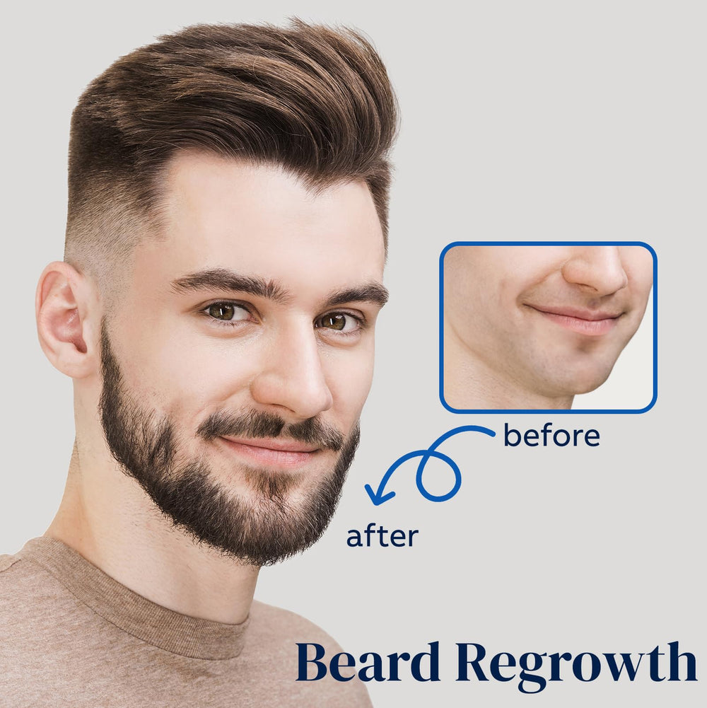 FUZYAT Minoxidil fórmula avanzada con biotina para fortalecer el cabello.